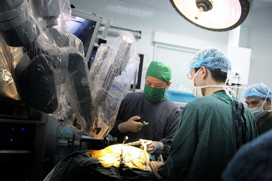 Phẫu thuật u nang ống mật chủ cho một bệnh nhi bằng kỹ thuật nội soi robot tại Bệnh viện Nhi trung ương