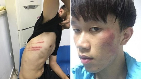 
Hai cầu thủ của CLB Giang Tô bị thương khá nặng sau vụ ẩu đả
