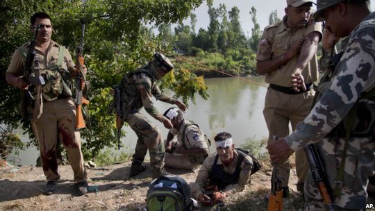 
Một số cảnh sát Ấn Độ bị thương trong vụ tấn công. Ảnh: AP
