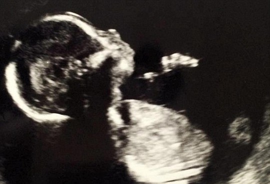 Courtney Ngobe chia sẻ bức ảnh siêu âm em bé 8 tháng