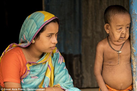
Cậu bé 4 tuổi bên cạnh mẹ. Ảnh: Cover Asia Press
