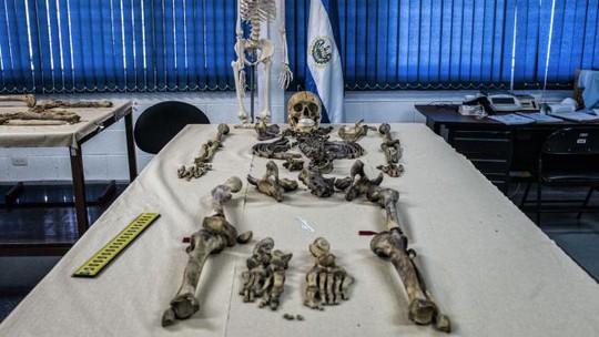 
Bộ xương vô danh tìm thấy tại một ngôi mộ tập thể đang được xét nghiệm tại khoa Nhân chủng học pháp y của Viện Legal Medicine. Ảnh: Juan Carlos/Newsmodo
