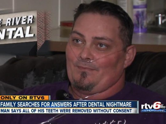 
Thay vì nhổ 4 cái răng, phòng khám đã xử cả hàm của anh Donny Grigsby. Ảnh: WRTV
