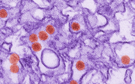 Virus Zika qua kính hiển vi điện tửẢnh: MEDICAL XPRESS