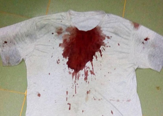 Chiếc áo của nạn nhân ướt đẫm máu