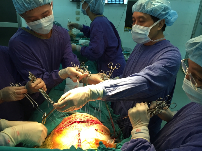 Một ca phẫu thuật ghép gan cho các bác sĩ Việt Nam thực hiện