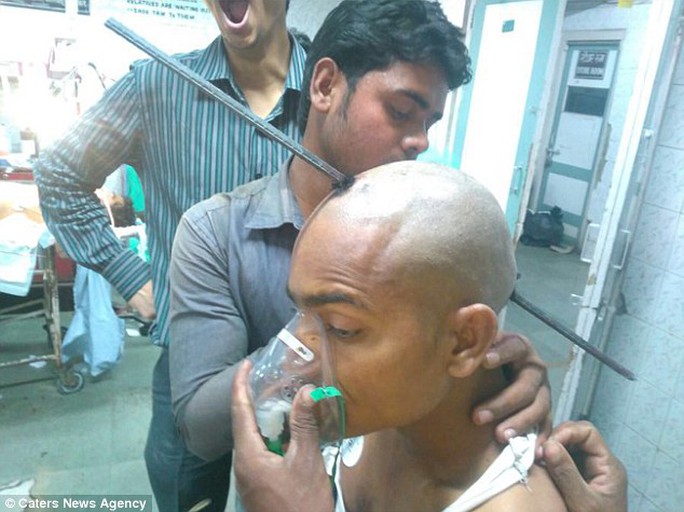 Anh Guddu vẫn có ý thức sau khi bị thanh sắt đâm xuyên hộp sọ. Ảnh: Caters News Agency