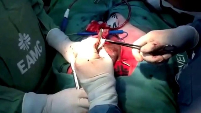 Giới chuyên môn khuyến cáo quý ông nên tìm đến thầy thuốc nếu gặp nạn trong chuyện ấy - Ảnh minh họa