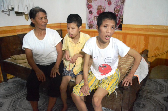 
Hai đứa con tật nguyền, dị dạng do nhiễm chất độc da cam/dioxin của vợ chồng ông Hoàng Công Uẩn ở huyện Vụ Bản, tỉnh Nam Định. Ảnh: Nguyễn Hưởng

