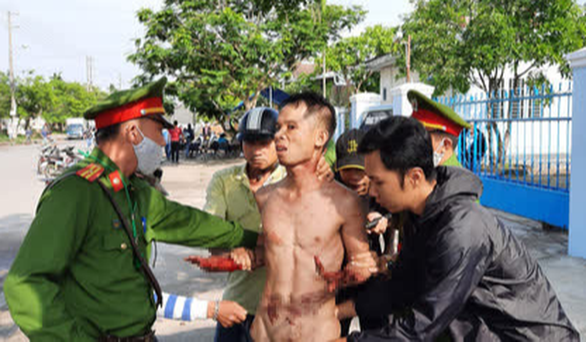 Kẻ ng&aacute;o đ&aacute; ở Quảng Nam tự cắt cổ, li&ecirc;n tục la giết người - Ảnh 1.