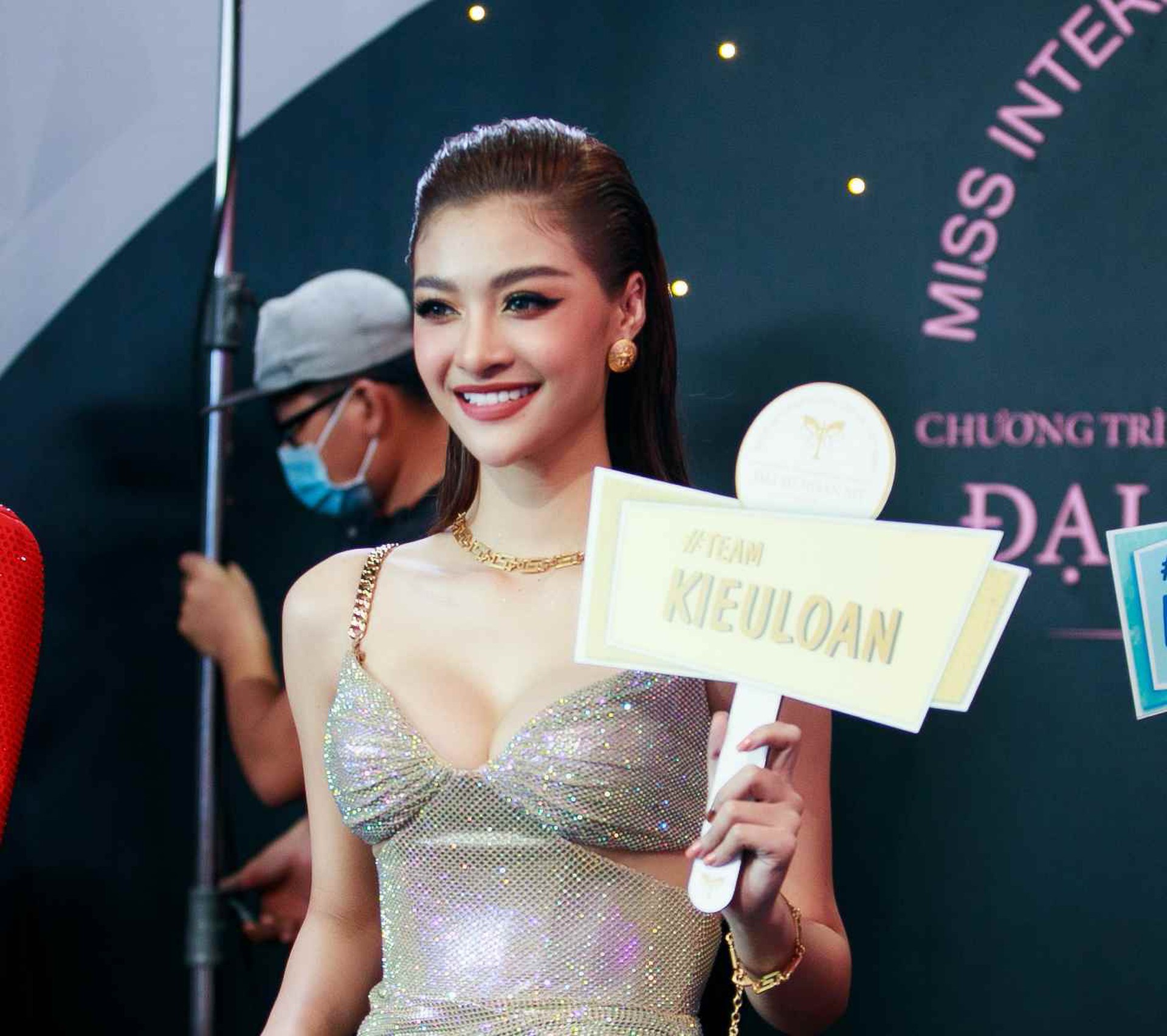 &Aacute; hậu g&acirc;y nhức mắt v&igrave; v&ograve;ng 1 vừa độ - Ảnh 9.
