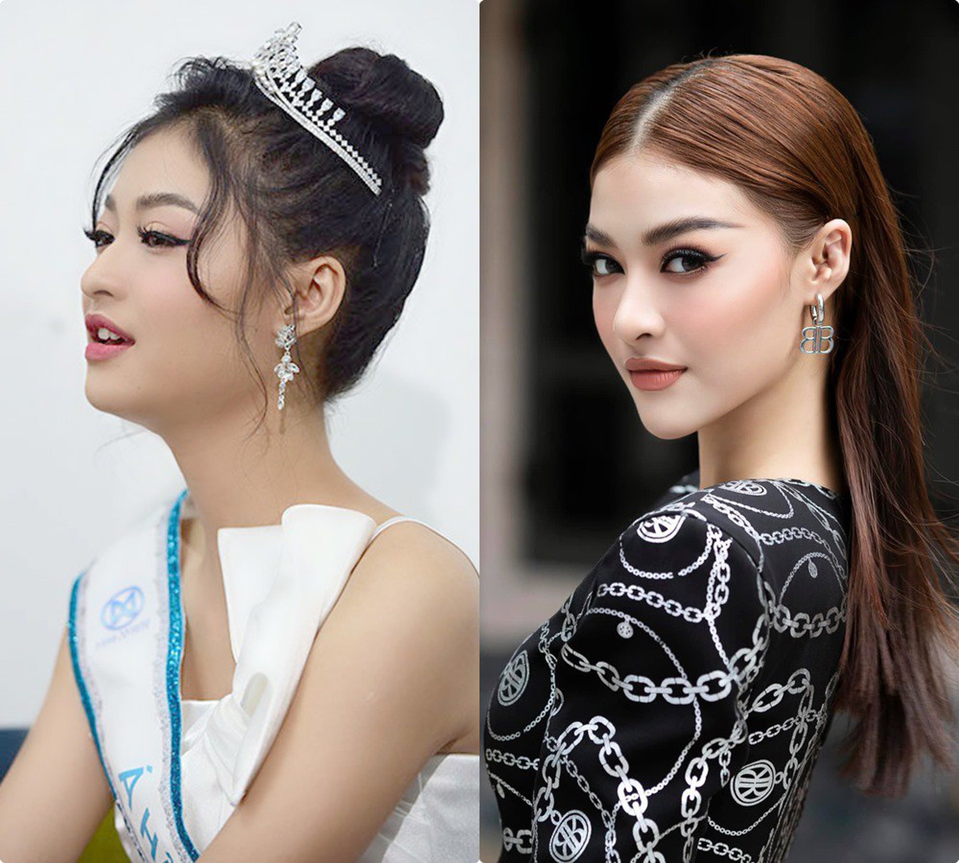 &Aacute; hậu g&acirc;y nhức mắt v&igrave; v&ograve;ng 1 vừa độ - Ảnh 5.