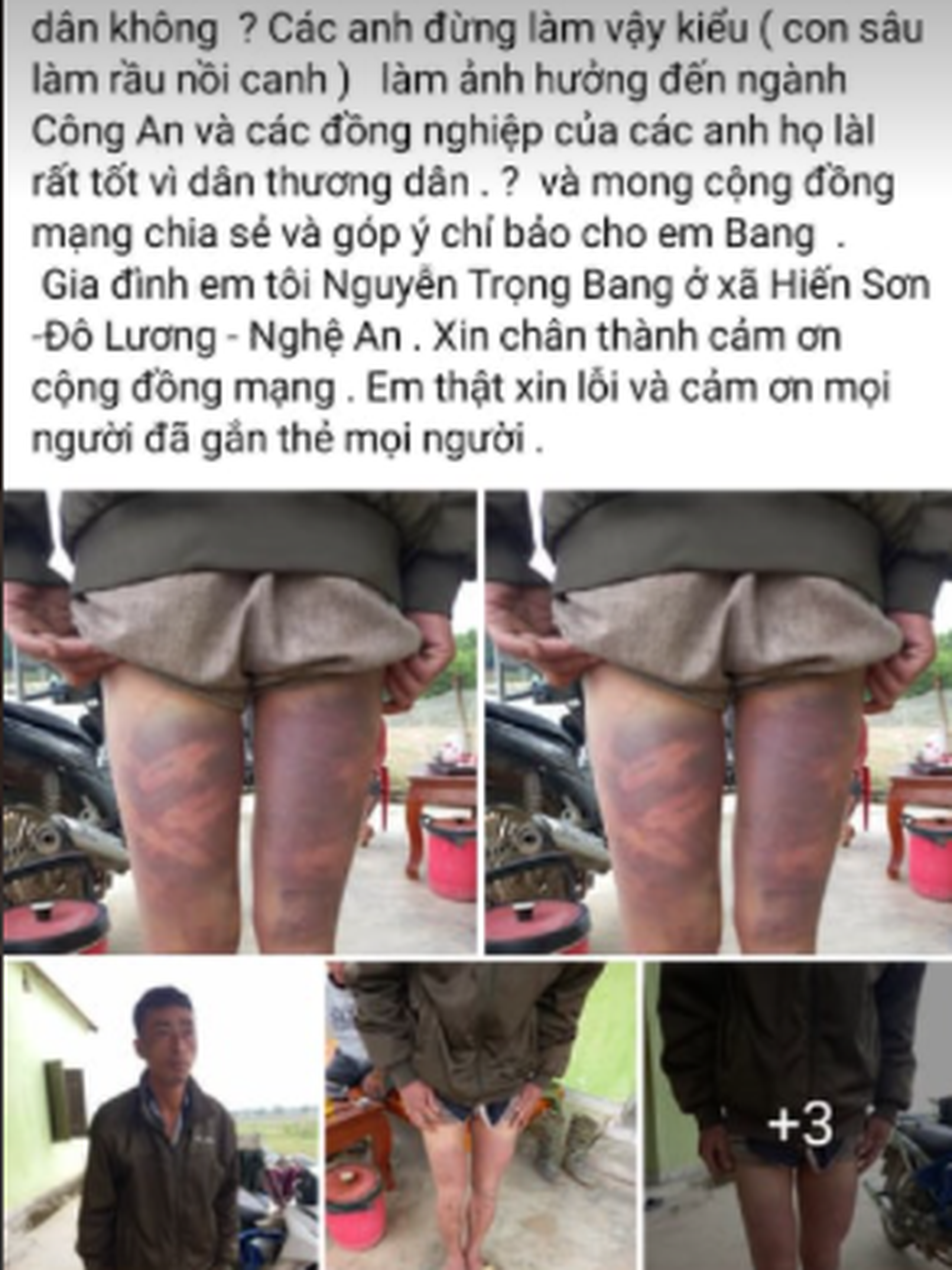 X&ocirc;n xao th&ocirc;ng tin người đ&agrave;n &ocirc;ng bị h&agrave;nh hung khi được đưa về trụ sở UBND x&atilde; - Ảnh 1.