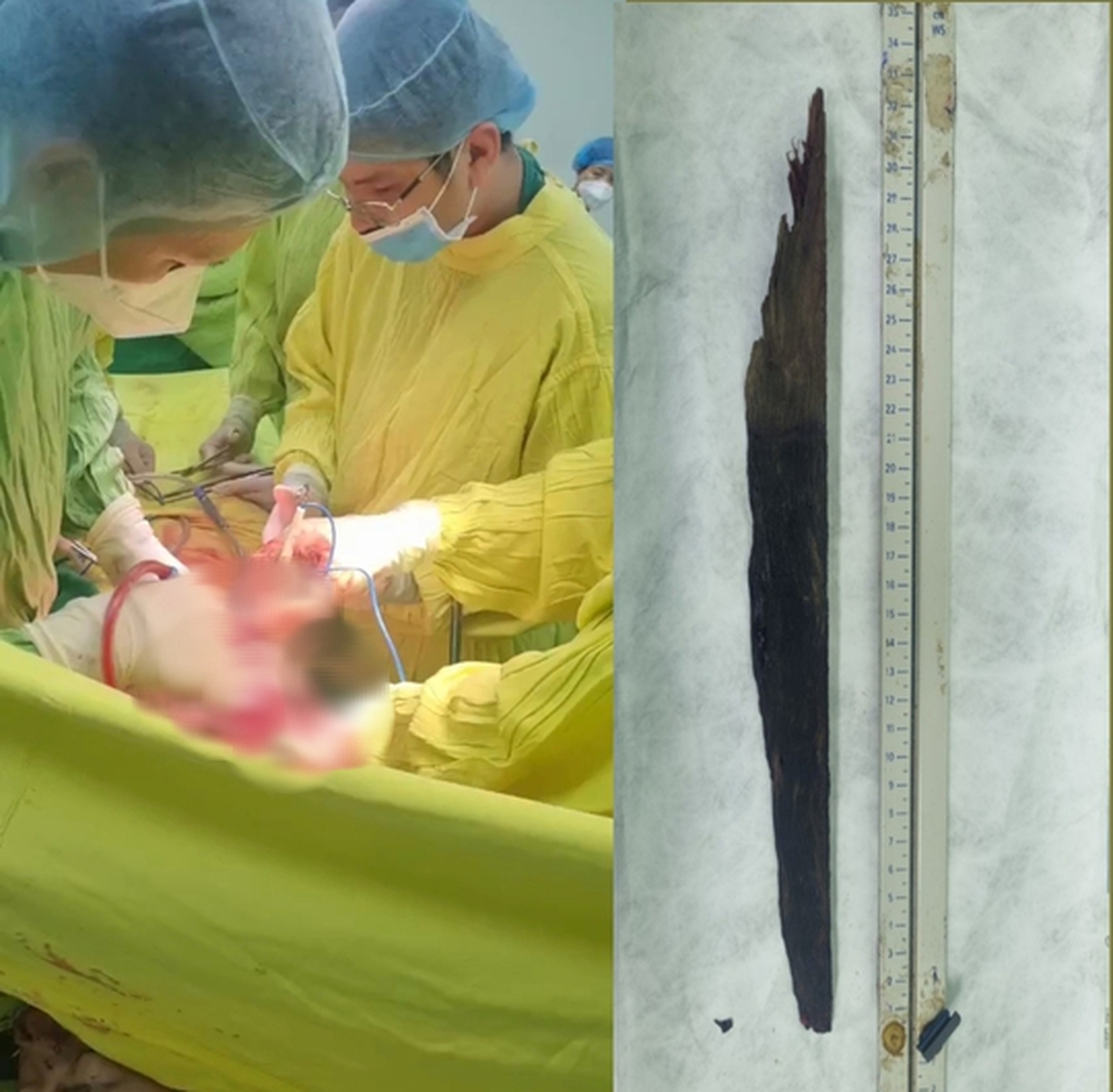 Thiếu ni&ecirc;n 17 tuổi gặp tai nạn thương t&acirc;m v&igrave; tr&aacute;nh con ch&oacute; lao ra đường - Ảnh 1.