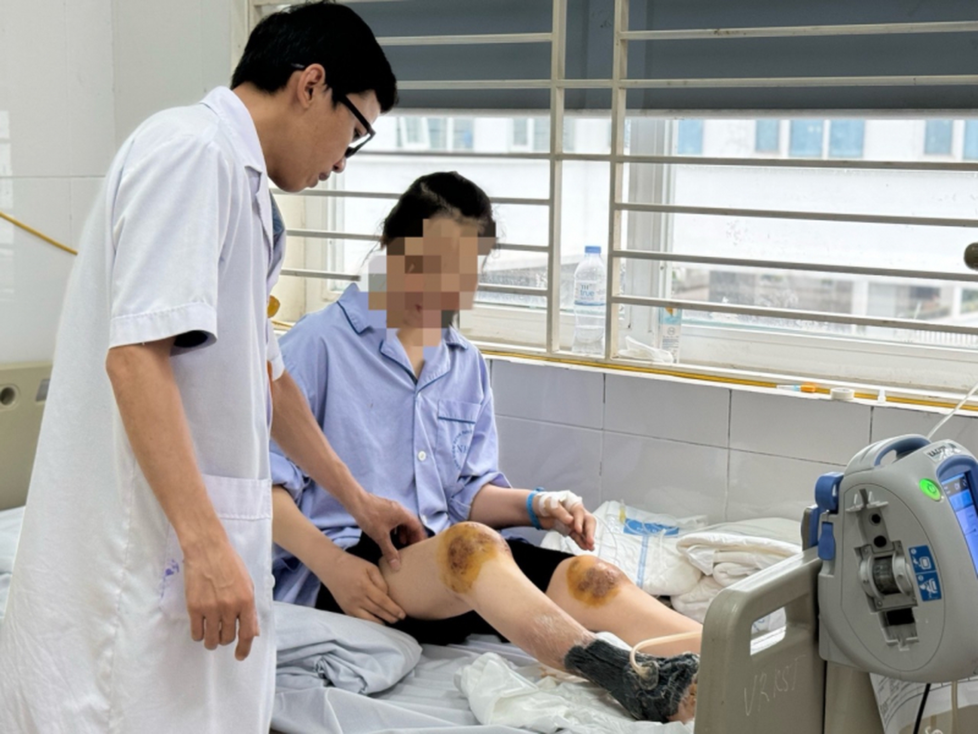 Chữa bệnh bằng ong đốt, người phụ nữ bị hoại tử ch&acirc;n- Ảnh 1.