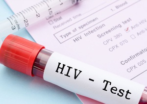 Vì sao độ tuổi được xét nghiệm HIV tự nguyện giảm xuống đủ 15 tuổi?