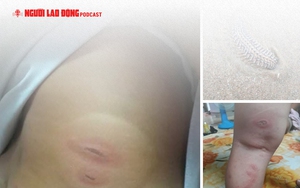 H&igrave;nh ảnh: B&atilde;i Sau Vũng T&agrave;u xuất hiện s&acirc;u biển, sứa - Ảnh 9.