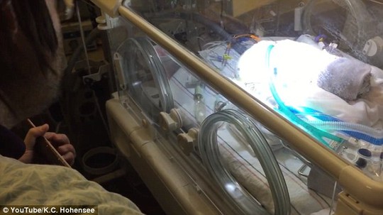 Chris Picco took his guitar to baby Lennon James bedside and is seen gently strumming the Paul McCartney song while his baby son lies in an incubator in the Intensive Care Unit