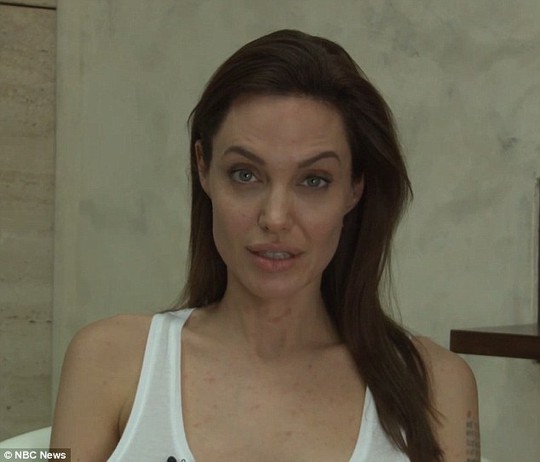 Angelina Jolie bị thủy đậu
