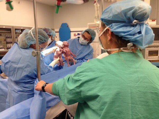 Hai bé gái nắm tay nhau sau khi chào đời