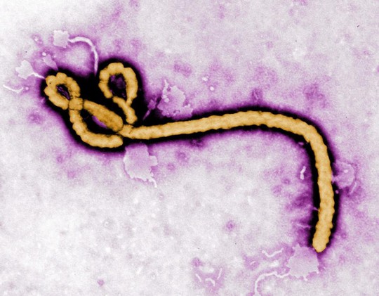 2/3 dân số Mỹ dương tính với chứng… “sợ Ebola”