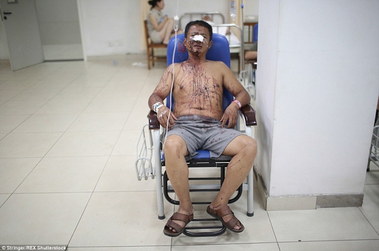 Một người bị thương được điều trị tại bệnh viện Ảnh: REX Shutterstock