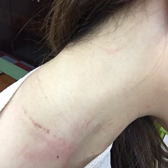 
Nữ nhân viên hàng không của Vietnam Airlines bị hành khách túm áo, đánh vào cổ và đầu
