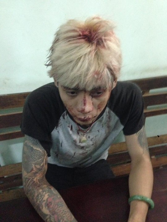 
CSGT khẳng định không đánh người thanh niên này. Máu túa trên đầu là do đầu anh ta đập vào xe (ảnh từ Facebook)
