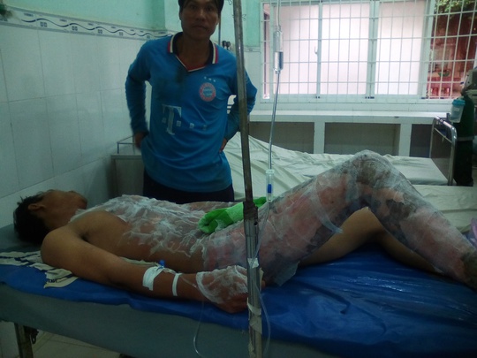 
Bệnh nhân Trần Thanh Dũng đang được điều trị tại Bệnh viện Đa khoa Trà Vinh

