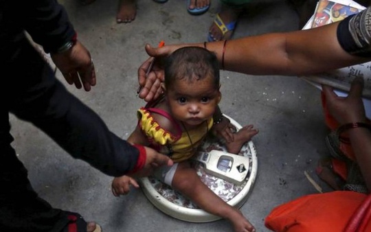 
Một em bé được cân tại thủ đô New Delhi - Ấn Độ theo chương trình của chính phủ. Ảnh: Reuters
