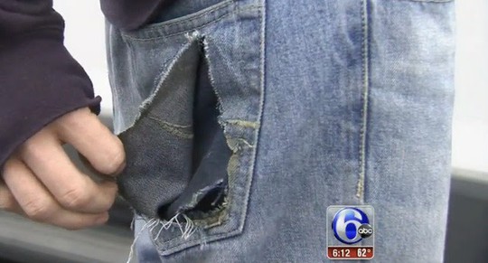 
Chiếc iPhone phát nổ khiến quần của Darin bị rách ở túi sau.

