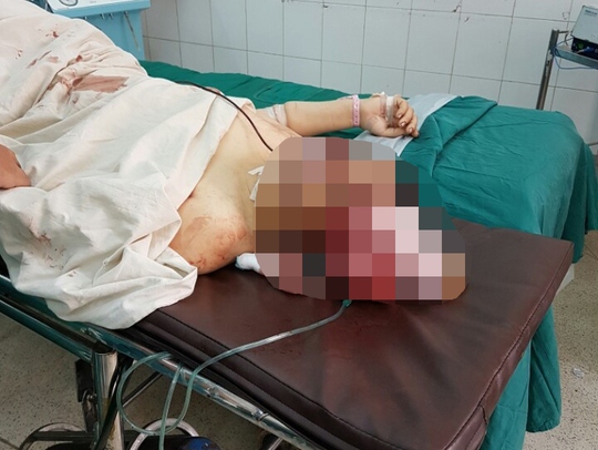
Chị Thảo đang được cấp cứu tại Bệnh viện Đa khoa tỉnh Đắk Lắk

