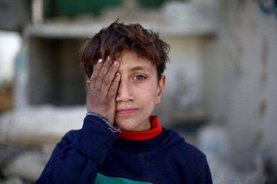 Syria: Xót thương bé 3 tháng tuổi chỉ còn một mắt - Ảnh 8.