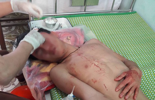 Lao xe máy vào trường rú ga, đánh thầy giáo, học sinh khâu 10 mũi - Ảnh 1.