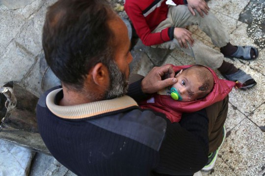 Syria: Xót thương bé 3 tháng tuổi chỉ còn một mắt - Ảnh 4.