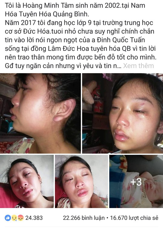 Mẹ trẻ 16 tuổi đăng Facebook cầu cứu vì bị chồng liên tục bạo hành - Ảnh 2. Mẹ trẻ 16 tuổi đăng Facebook cầu cứu vì bị chồng liên tục bạo hành - Ảnh 2.