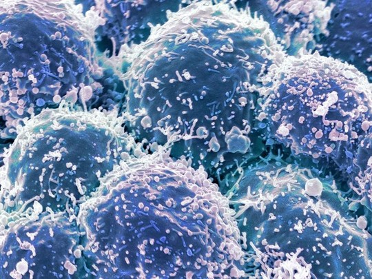 Chế tạo thành công loại virus chuyên diệt tế bào ung thư - Ảnh 1.