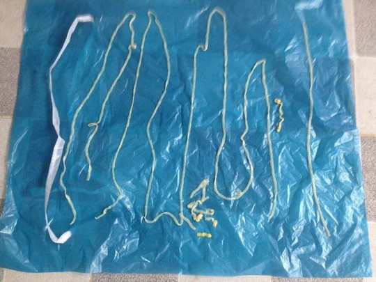 Ớn lạnh với ổ sán lợn phát hiện tại Bình Phước: 55 tỉnh thành có sán lợn - Ảnh 2. Ớn lạnh với ổ sán lợn phát hiện tại Bình Phước: 55 tỉnh thành có sán lợn - Ảnh 2.