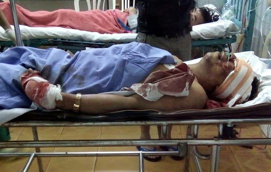 Một thầy giáo bị chém lún sọ nguy kịch - Ảnh 1.