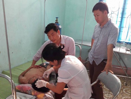 Em bị tát cảnh cáo, anh đến trường đánh thầy giáo gãy mũi - Ảnh 1.