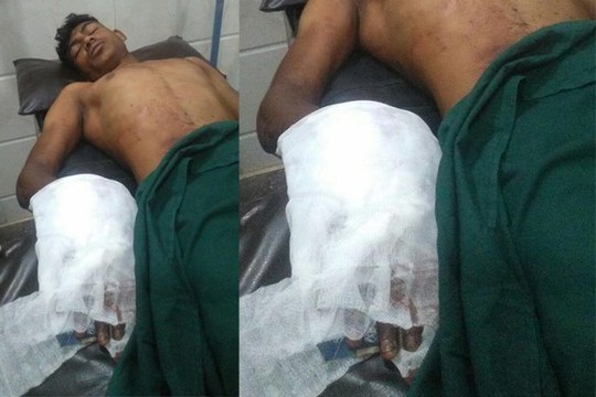 Bị cha chặt tay vì nghiện xem “phim người lớn” - Ảnh 1.