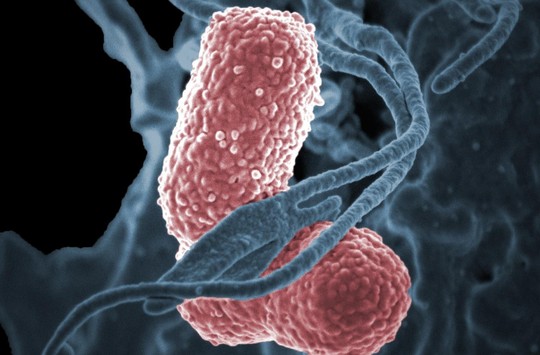 Vi khuẩn “ác mộng” giết chết 50% số người nhiễm bệnh - Ảnh 1.