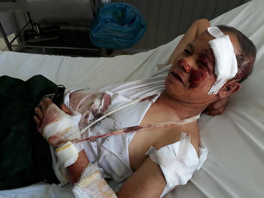 Tai nạn thảm khốc trên đèo Khánh Lê, 3 người chết, hơn 20 người bị thương - Ảnh 2.