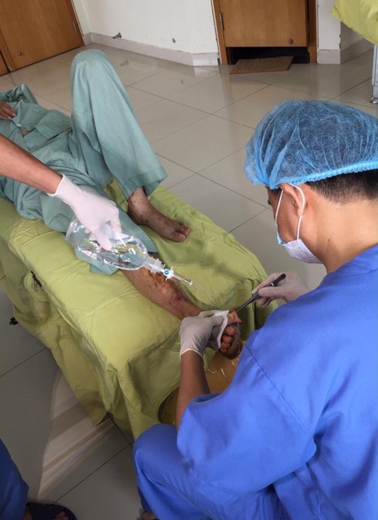 Bác sĩ rùng mình cứu bàn chân hoại tử do bệnh nhân tự chữa đái tháo đường - Ảnh 1.