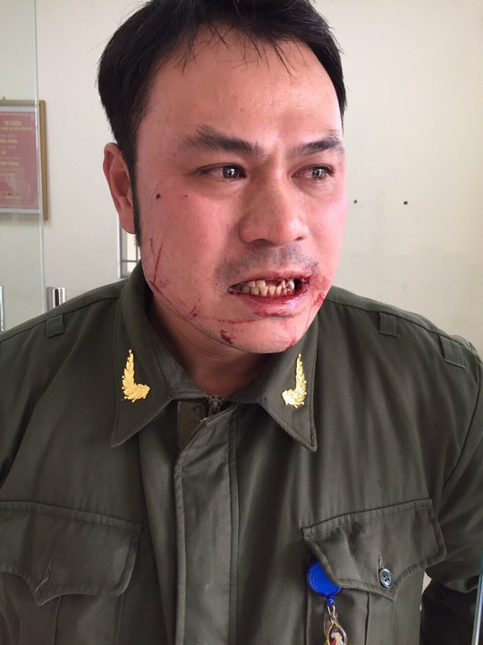 Nhân viên an ninh hàng không Nội Bài bị cò mồi đánh gãy răng - Ảnh 2.