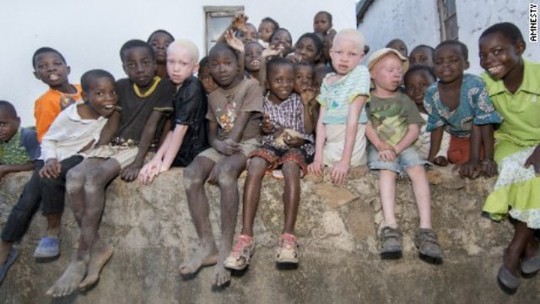 Tanzania: Tìm thấy 10 thi thể trẻ em bị bắt cóc không còn nguyên vẹn - Ảnh 1.