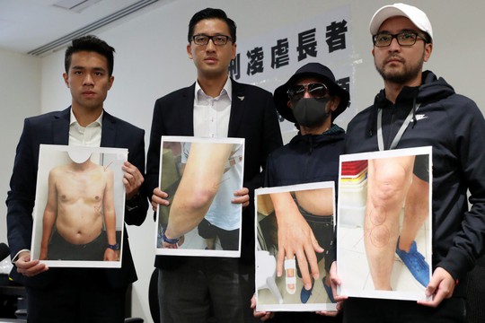 Cảnh sát Hồng Kông tra tấn cụ ông trong bệnh viện - Ảnh 1.