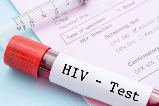 Vì sao độ tuổi được xét nghiệm HIV tự nguyện giảm xuống đủ 15 tuổi? - Ảnh 1.