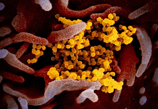 Tiết lộ hình ảnh mới của virus corona chủng mới - Ảnh 1.
