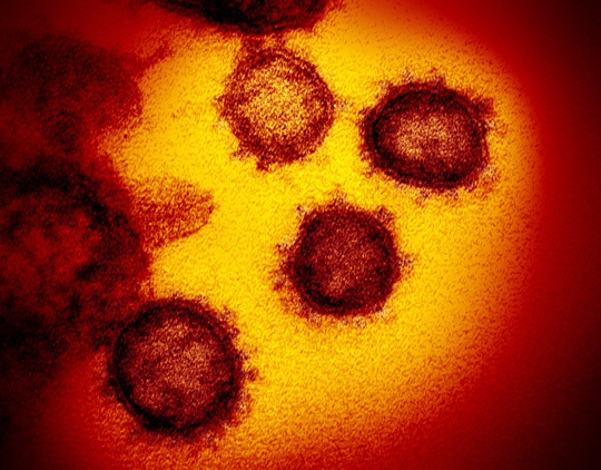 Tiết lộ hình ảnh mới của virus corona chủng mới - Ảnh 3.
